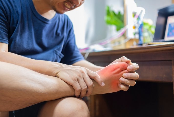 Hyper-urecemia (High uric acid levels)